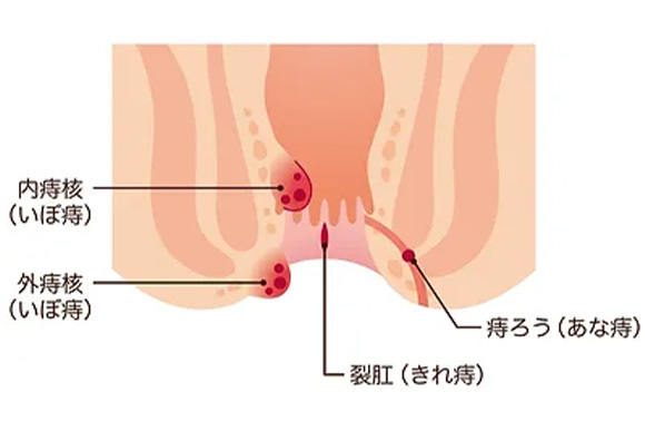 肛門外科